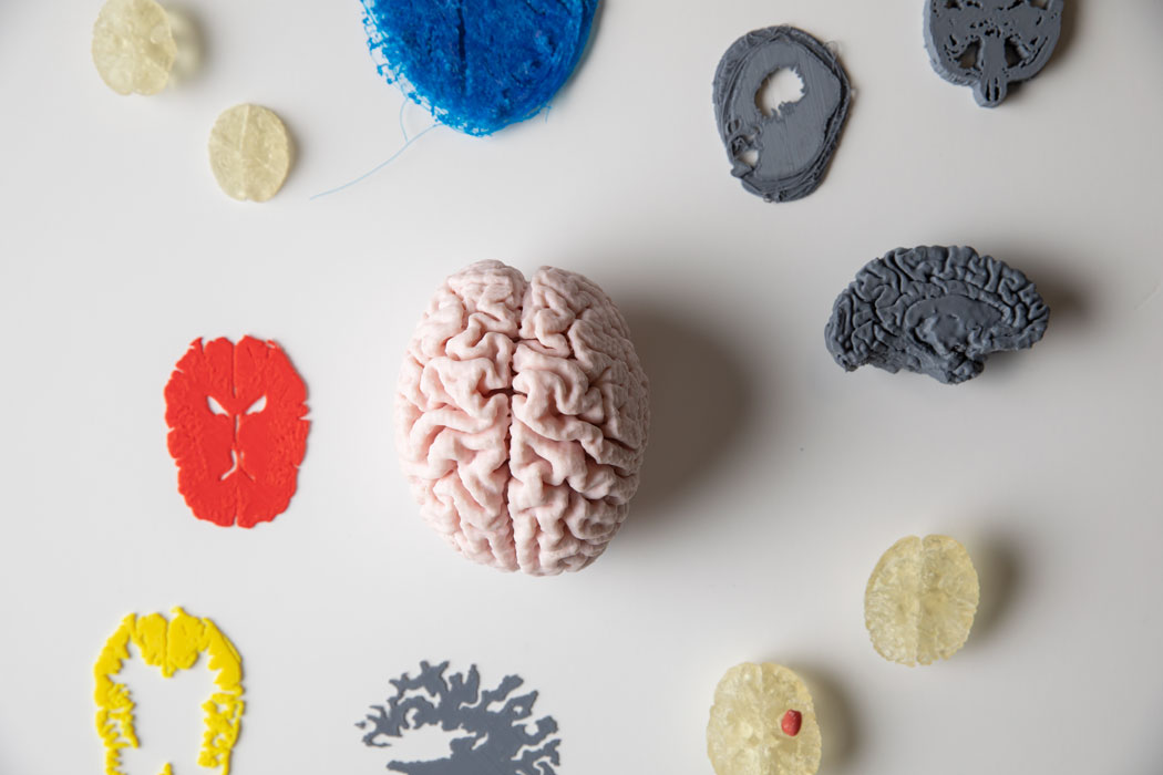 3d printed brains