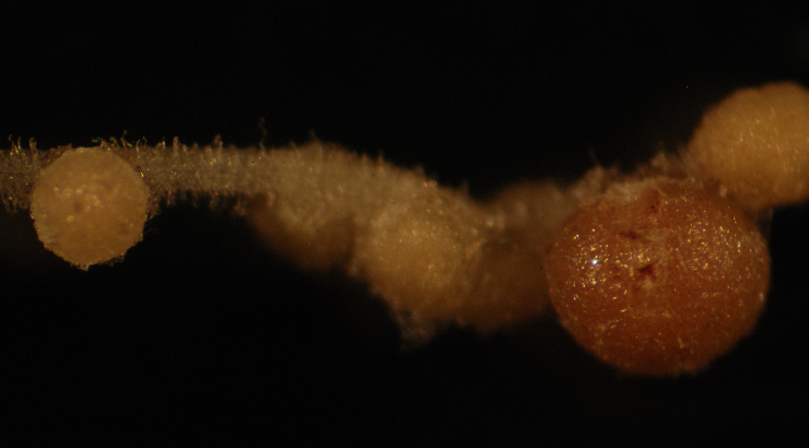 A cluster of nodules on the roots of a plant